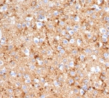 Synaptophysin antibody