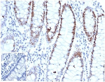 MSH6 antibody