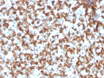 FSH beta antibody