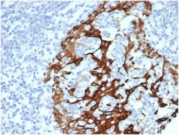 Keratin 6A antibody