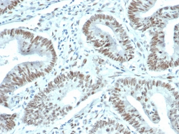 FOXP1 antibody
