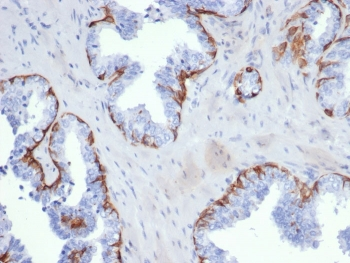 Cytokeratin 5 antibody