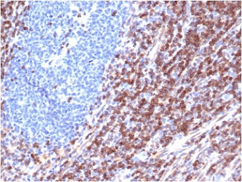 Bcl-2 antibody