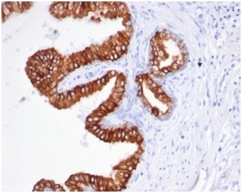 EpCAM antibody