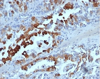 Cytokeratin 20 antibody