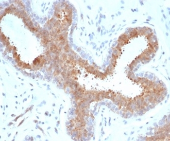 BAP1 antibody