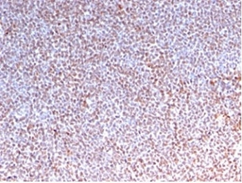 ALK antibody