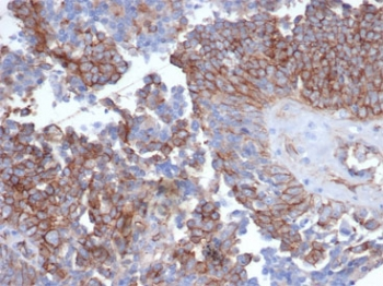 N-Cadherin antibody
