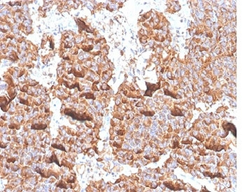Prolactin antibody