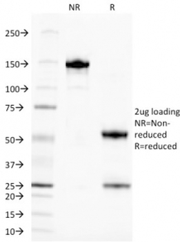 TAG-72 antibody