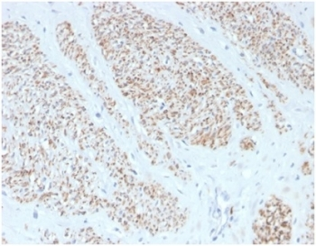 SMMHC antibody