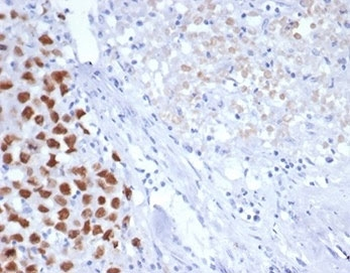 SALL4 Antibody / ZNF797