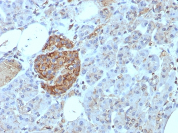 CD99 Antibody / MIC2
