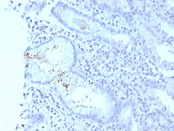 Helicobacter pylori Catalase Antibody