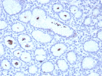 Helicobacter pylori Catalase Antibody