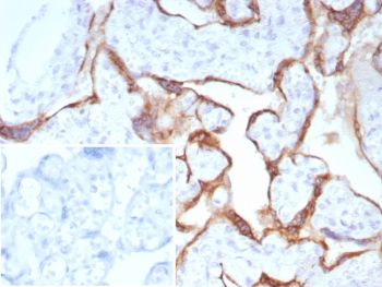 PAPP-A Antibody / Pappalysin-1