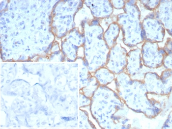 PD-L1 Antibody / B7-H1 / CD274