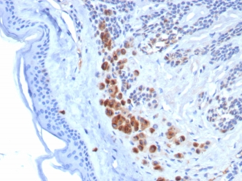 TRP1 / Tyrosinase-Related Protein-1 Antibody