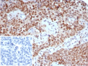 TRPS1 Antibody / Tricho-rhino-phalangeal syndrome type I