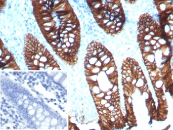 CDH17 Antibody / Cadherin 17