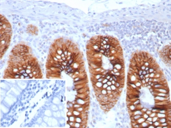 CDH17 Antibody / Cadherin 17