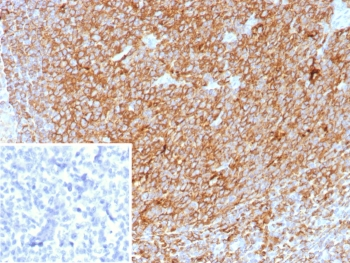 Pan-HLA Antibody MHC II (DP/DQ/DR)