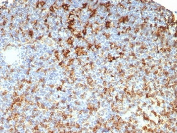 HLA-DRB Antibody