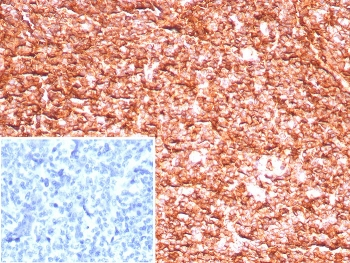 HLA-ABC Antibody (MHC I)