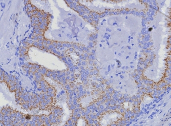 AMACR / p504S Antibody (Prostate Cancer Marker)