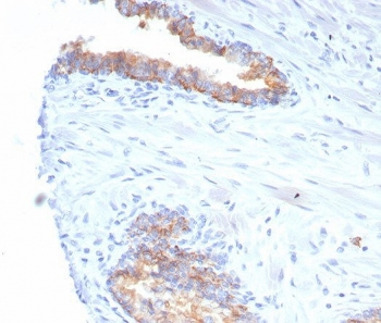 CD38 Antibody