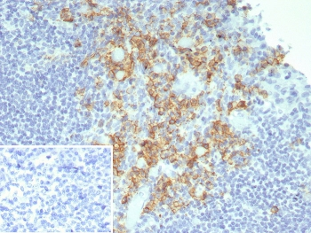 CD38 Antibody