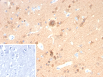 PGP9.5 / UchL1 Antibody