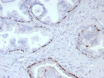 p63 Antibody / Tumor protein 63