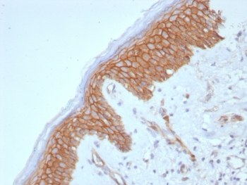 CTNNB1 Antibody / Beta Catenin