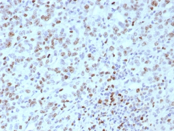 MLH1 Antibody / MutL Homolog 1