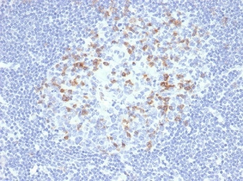 PDCD1 Antibody / PD-1 / PD1