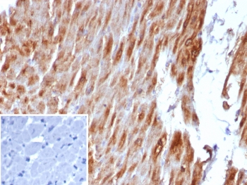 Desmin Antibody