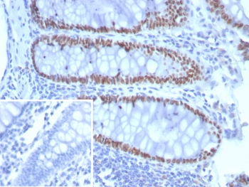 SATB2 Antibody