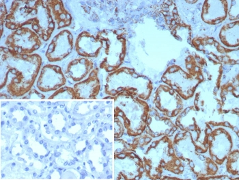 HSP60 Antibody