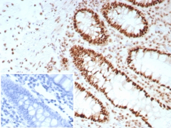 SATB2 Antibody