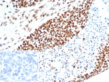 MSH6 Antibody