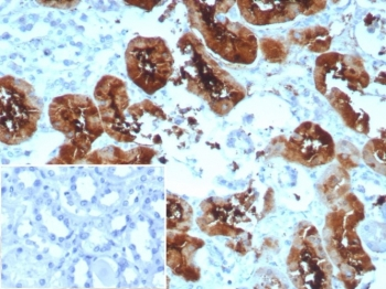 FABP1 Antibody