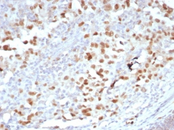 PRAME Antibody / OIP-4