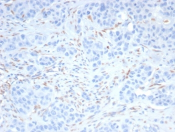 SALL4 Antibody / ZNF797