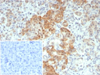 INSM1 Antibody / Insulinoma associated protein 1