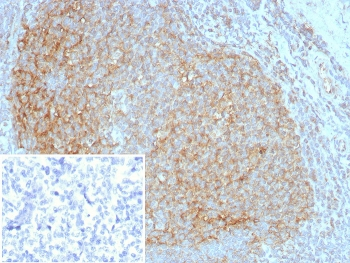 CD35 Antibody / CR1