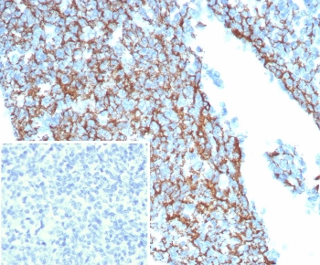 CD35 Antibody / CR1