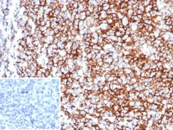 CD35 Antibody / CR1