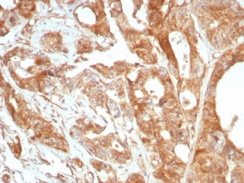 Podoplanin Antibody / gp36