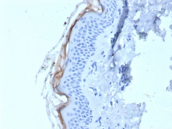 Kallikrein 5 Antibody / KLK5